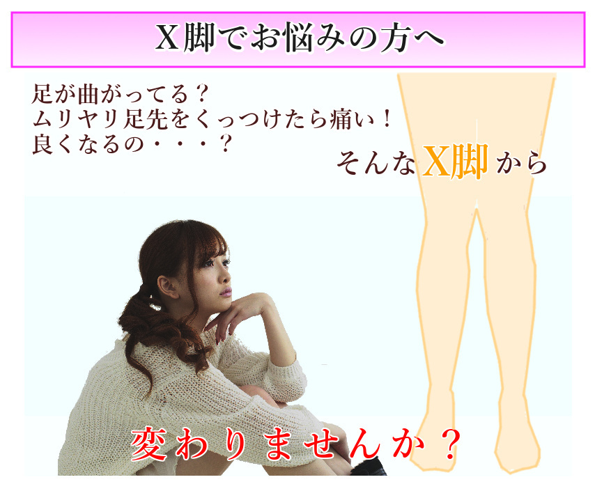 X脚