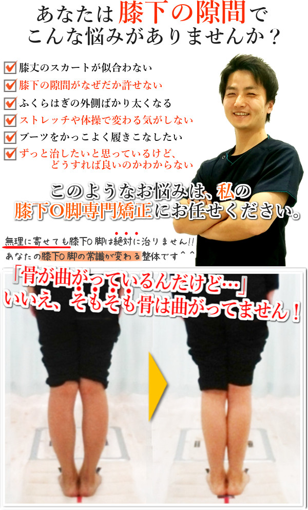膝下O脚(XO脚)